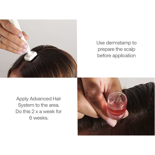 calecim advanced hair system instruction dermoi!