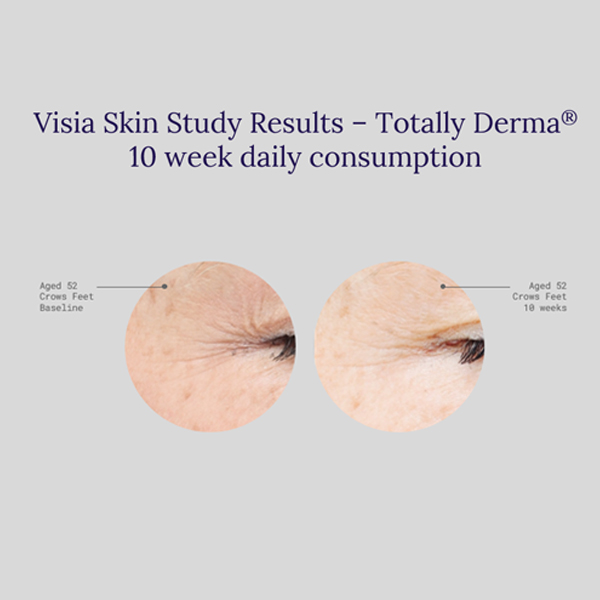 totally derma before and after image from clinical trial